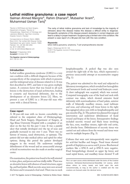 Lethal Midline Granuloma: a Case Report