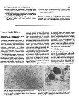 Identification of Immunoreactive Atrial Natriuretic Peptide in Atrial Amyloid