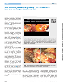 Spectrum of Biliary Parasites Affecting the Biliary Tree (Fasciola Hepatica, Echinococcus Granulosus,Andascaris Lumbricoides)