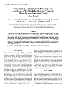 Usefulness of Intravascular Ultrasonography Monitoring of Coil Embolization for Traumatic Direct Carotid-Cavernous Fistula —Case Report—