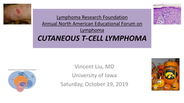 Cutaneous T-Cell Lymphoma