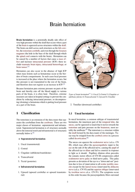 Brain Herniation