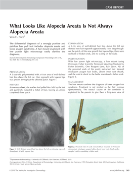 What Looks Like Alopecia Areata Is Not Always Alopecia Areata Vera H