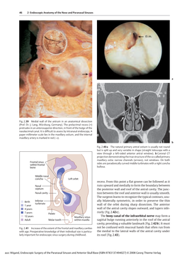 Endoscopic Surgery of the Paranasal Sinuses and Anterior Skull Base (ISBN 9783137494027) © 2008 Georg Thieme Verlag