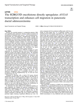 The H2BG53D Oncohistone Directly Upregulates ANXA3 Transcription and Enhances Cell Migration in Pancreatic Ductal Adenocarcinoma