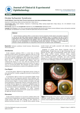 Ocular Ischaemic Syndrome