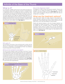 Arthritis of the Base of the Thumb