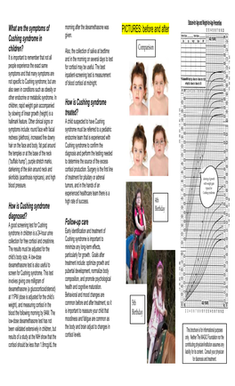 Cushing Syndrome in Childhood