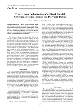 Transvenous Embolization of a Direct Carotid Cavernous Fistula Through the Pterygoid Plexus