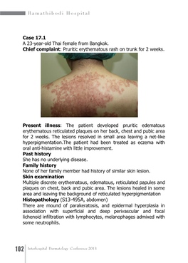 Case 17.1 a 23-Year-Old Thai Female from Bangkok. Chief Complaint: Pruritic Erythematous Rash on Trunk for 2 Weeks. Present Illn