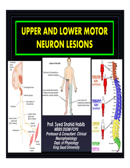 Upper and Lower Motor Neuron Lesions