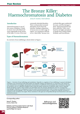 The Bronze Killer: Haemochromatosis and Diabetes Jenny E