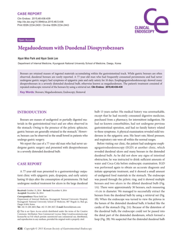 Megaduodenum with Duodenal Diospyrobezoars