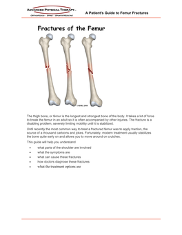 Femur Fractures