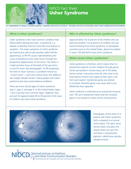 NIDCD Fact Sheet Usher Syndrome Hearing Balance U.S