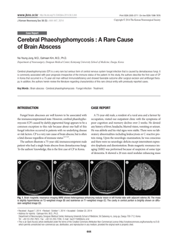 Cerebral Phaeohyphomycosis : a Rare Cause of Brain Abscess