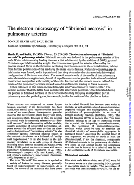 Fibrinoid Necrosis