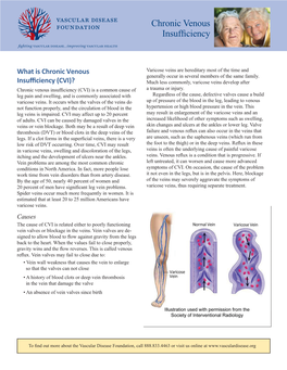 Chronic Venous Insufficiency