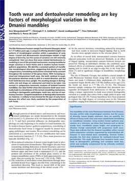 Tooth Wear and Dentoalveolar Remodeling Are Key Factors of Morphological Variation in the Dmanisi Mandibles