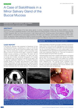 A Case of Sialolithiasis in a Minor Salivary Gland of the Buccal Mucosa