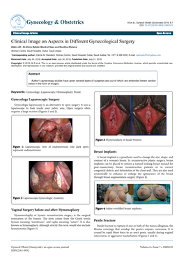 Clinical Image on Aspects in Different Gynecological Surgery