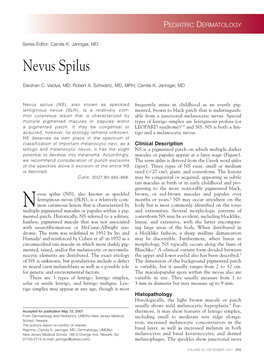 Nevus Spilus