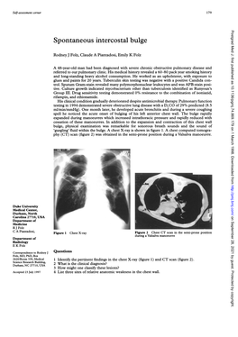 Spontaneous Intercostal Bulge