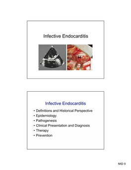 Infective Endocarditis