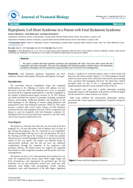 Hypoplastic Left Heart Syndrome in a Patient with Fetal Hydantoin Syndrome