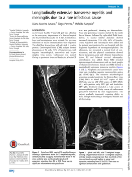 Longitudinally Extensive Transverse Myelitis and Meningitis Due to a Rare Infectious Cause Diana Moreira Amaral,1 Tiago Parreira,2 Mafalda Sampaio3