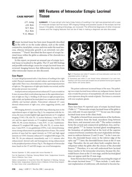 MR Features of Intraocular Ectopic Lacrimal Tissue