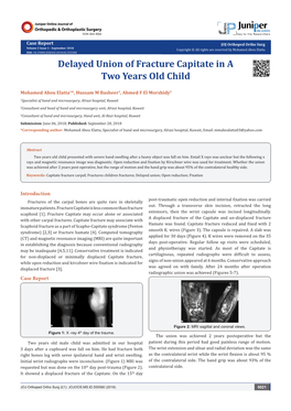 Delayed Union of Fracture Capitate in a Two Years Old Child