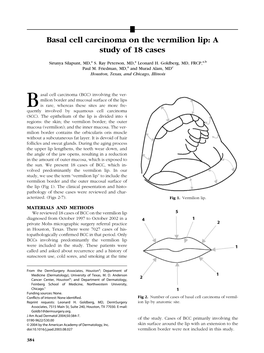 Basal Cell Carcinoma on the Vermilion Lip: a Study of 18 Cases