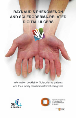 Related Digital Ulcers