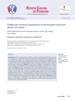 Vitiligo Type Cutaneous Manifestation of Chronic Graft-Versus-Host Disease