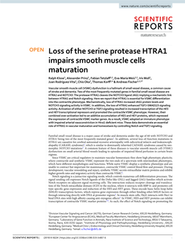 Loss of the Serine Protease HTRA1 Impairs Smooth Muscle Cells