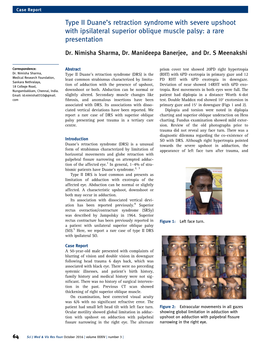 Type II Duaneis Retraction Syndrome with Severe