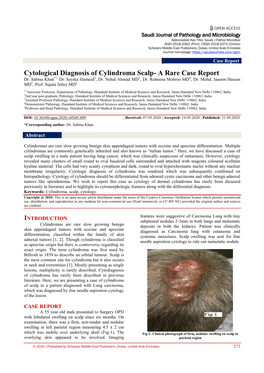 Cytological Diagnosis of Cylindroma Scalp- a Rare Case Report Dr