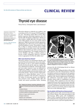 CLINICAL REVIEW Thyroid Eye Disease