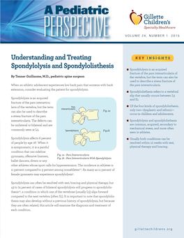 Understanding and Treating Spondylolysis and Spondylolisthesis