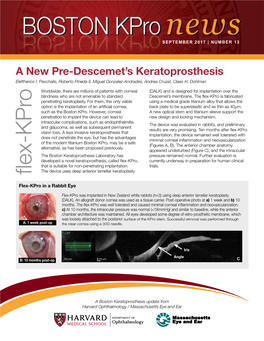Flex-Kpro Is Fabricated Penetrating Keratoplasty