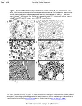 Comparison of Two Leukocytapheresis Protocols in a Case of Idiopathic