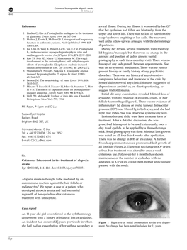 References MS Rajan, P Syam and C Liu Sussex Eye Hospital Eastern Road Brighton BN2 5BF, UK Correspondence