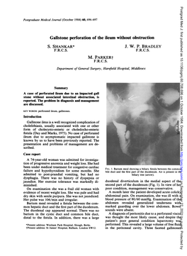 Gallstone Perforation of the Ileum Without Obstruction M. Parkert