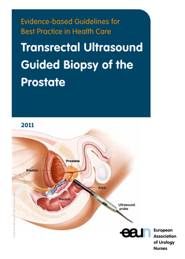 Transrectal Ultrasound Guided Biopsy of the Prostate