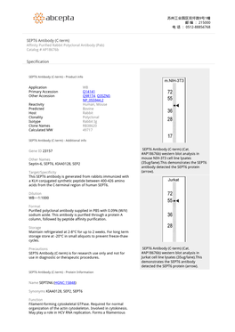 SEPT6 Antibody (C-Term) Affinity Purified Rabbit Polyclonal Antibody (Pab) Catalog # Ap18676b