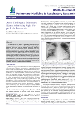 Acute Cardiogenic Pulmonary Edema Mimicking Right Up- Per Lobe