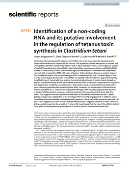 Identification of a Non-Coding RNA and Its Putative Involvement in The