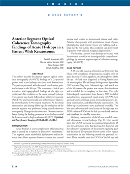 Anterior Segment Optical Coherence Tomography Findings of Acute Hydrops in a Patient with Keratoconus