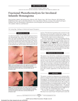 Fractional Photothermolysis for Involuted Infantile Hemangioma